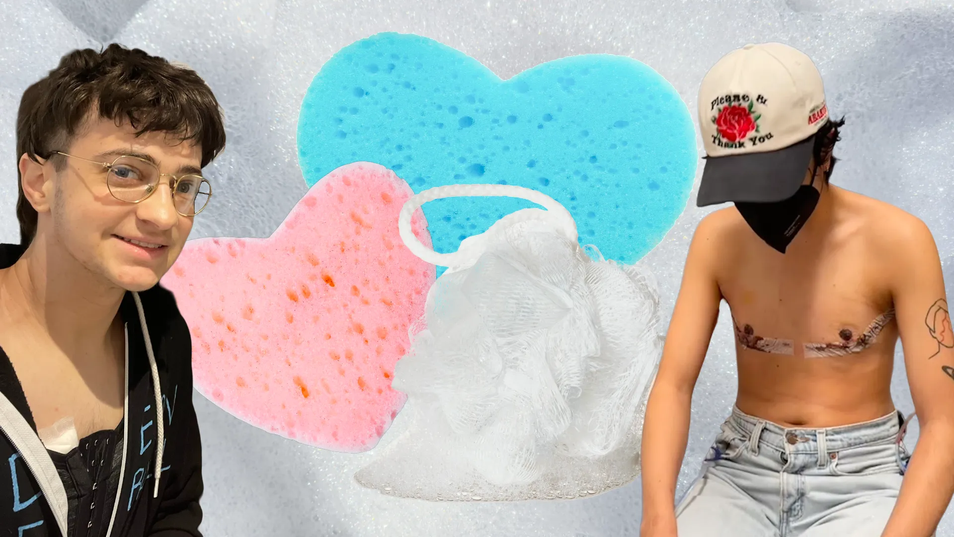 What’s a Sponge Bath Between Exes? The Politics of Top Surgery Aftercare